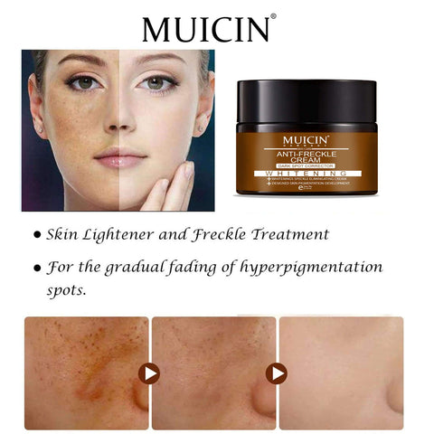 MUICIN - Intensive Spot Correction Cream - Diminish Freckles, Brighten Skin