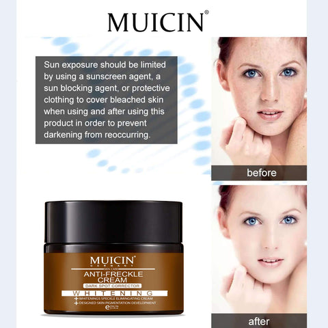 MUICIN - Intensive Spot Correction Cream - Diminish Freckles, Brighten Skin