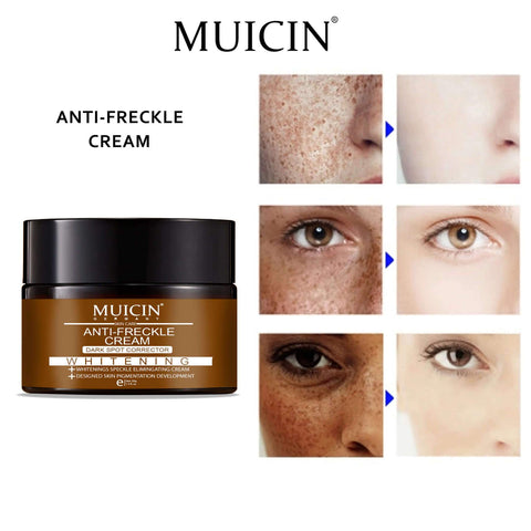 MUICIN - Intensive Spot Correction Cream - Diminish Freckles, Brighten Skin