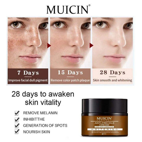 MUICIN - Anti-Freckle Deal
