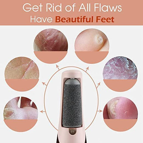 Home.Co- Callus Remover