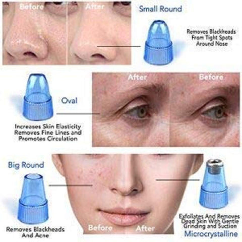 Home.Co - Derma Suction Vacuum