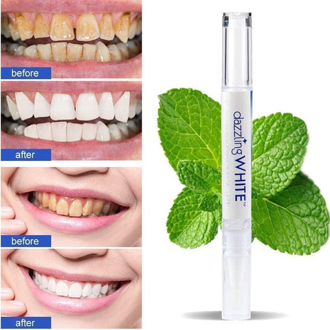 Home.Co - Teeth Whitening Device