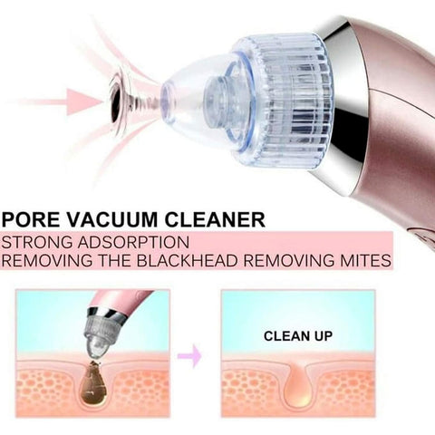 Home.Co - Blackhead Sunction Machine