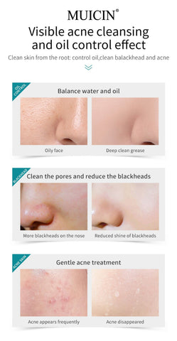 MUICIN - Tea Tree Bubble Foaming Facial Cleanser - Purifying Foam Magic